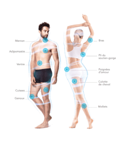 cryolipolyse